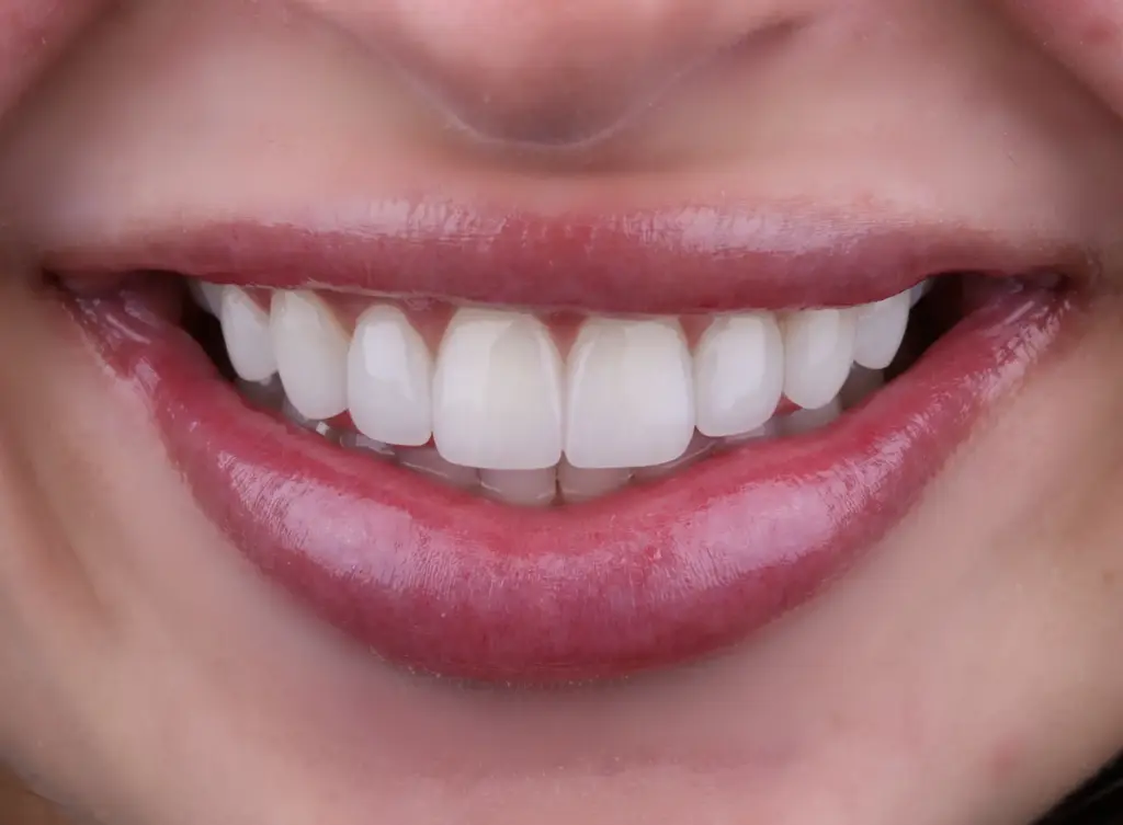 Sonrisa natural tras un tratamiento en Dayanna Contreras Dental Care Studio